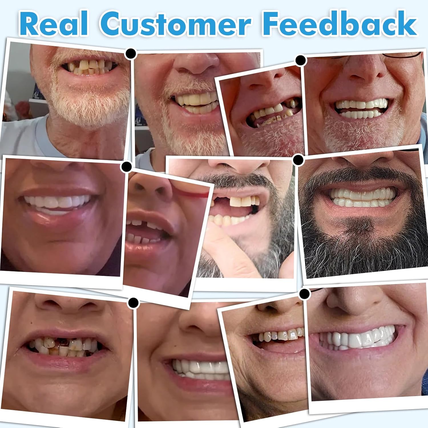 Teeth Covers